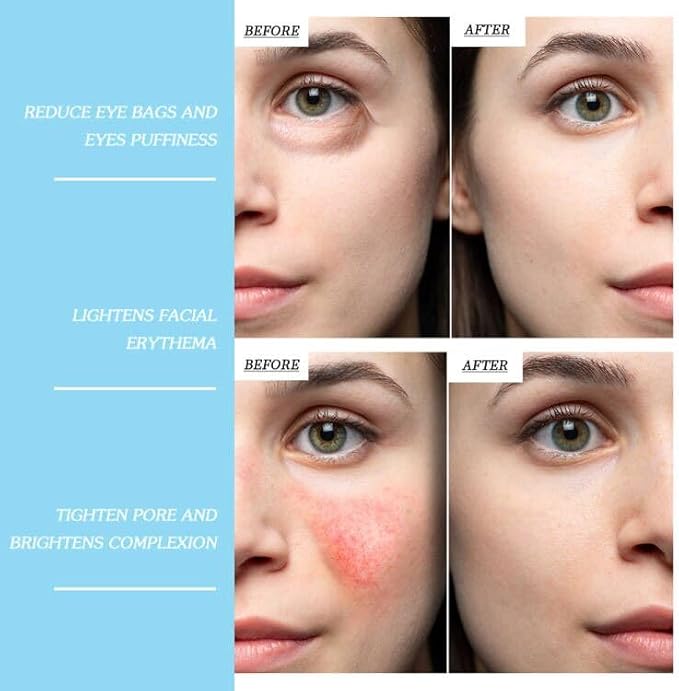 Ice Roller for Face & Body - Cold Therapy Tool to Depuff Eyes, Reduce Inflammation & Tighten Skin - with Protective Case (Blue)