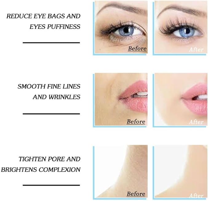 Ice Roller for Face & Body - Cold Therapy Tool to Depuff Eyes, Reduce Inflammation & Tighten Skin - with Protective Case (Blue)