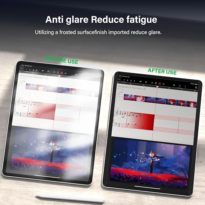 Magnetic 360° Privacy Screen Protector for iPad Pro 11 Inch 2025 M5 (8th Generation) Case Friendly Blue light Blocker Anti-glare Filter, Removable Film Support Apple Pencil-A2836/A2837/A3006/A3357/A3358/A3359