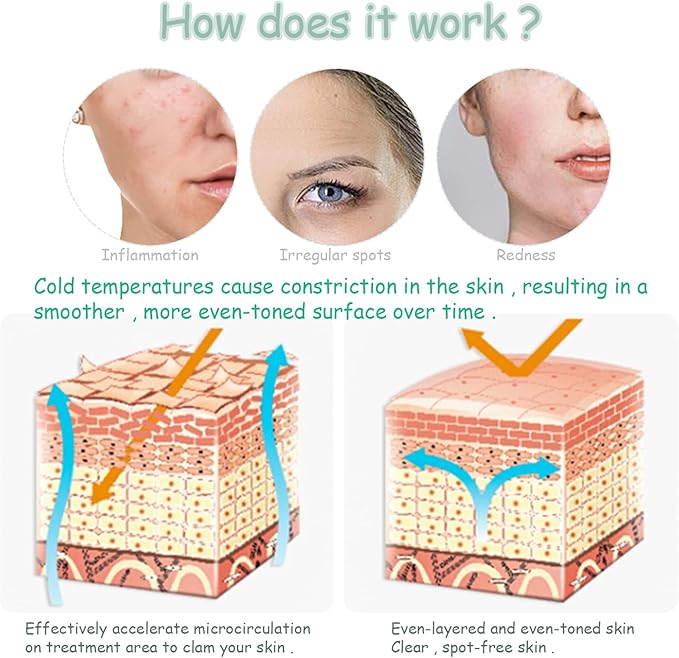 Ice Roller for Face,Cold Facial Massager for Eye Puffiness,Skin Care Tools for Migraine Relief and Blood Circulation (Purple)