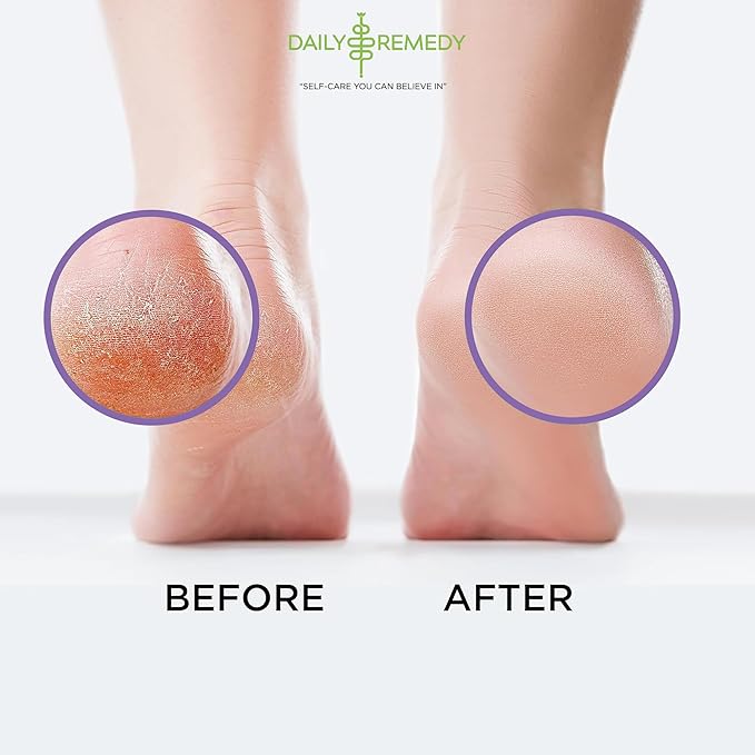 Calming Lavender Foot Soak with Epsom Salt, Made in USA, Foot Soak Soothes Tired Feet, Athletes Foot, Stubborn Foot Odor, Softens Calluses & Helps Treat Toenail, 16 oz 1 lb