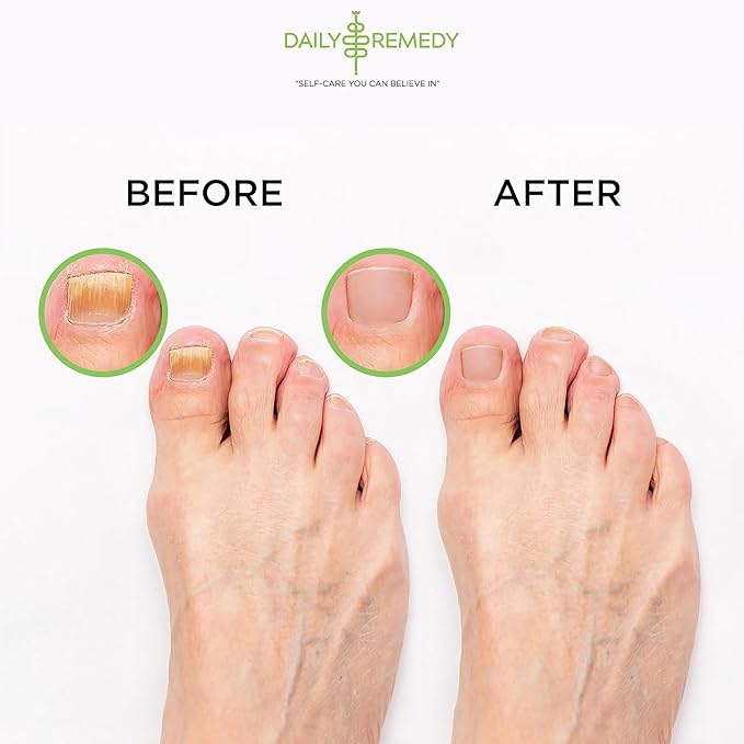 Tea Tree Oil Foot Soak with Epsom Salt - Made in USA - for Toenail irritations, Athletes Foot, Stubborn Foot Odor Scent, Softens Calluses & Soothes Sore Tired Feet - 2 Pack