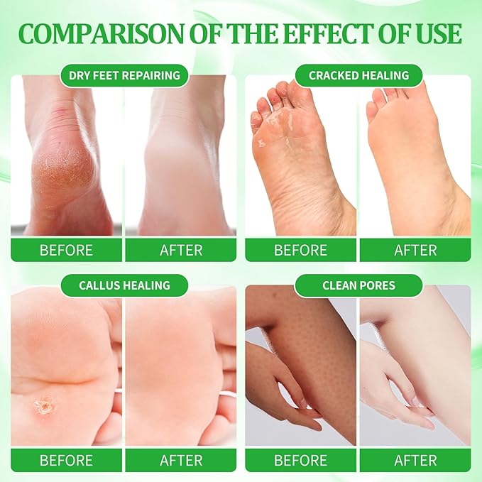 Pedicure Kit Foot Soak Set: Bubble Salt, Sugar Scrub, Massage Mask, Massage Lotion in a Box, 4 Step Foot Spa Kit for Dry Feet, Calluses and Tired Feet(3 Set Jasmine)