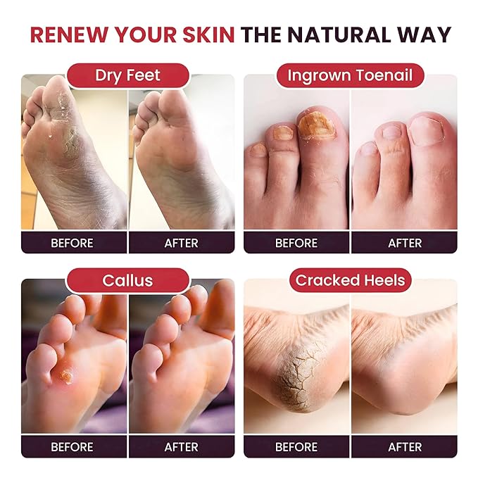 Muscle Care Foot Soak with Epsom Salts – Refreshing Blend for Relaxation & Foot Care – Helps Soften Skin – Soothes Tired Feet, Invigorating Scent, Spa Pedicure – Made in USA – 16oz (Pack of 2)