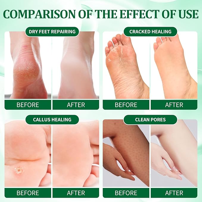 Pedicure Kit Foot Soak Set: Bubble Salt, Sugar Scrub, Massage Mask, Massage Lotion in a Box, 4 Step Foot Spa Kit for Dry Feet, Softens Calluses(3 Set Cucumber)