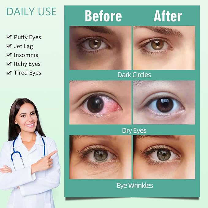 Serfeymi 22 Packs Steam Eye Mask-Disposable Cornea Care Rest Self Heating Eye Mask,Warm Eye Compresses for Dry Eyes,Sleep,Spa,Travel Essentials & Relaxation Gifts,Stocking Stuffers-Mixed 3 Scents