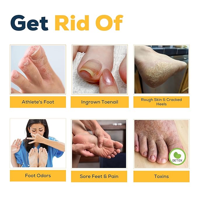 Citrus Detox Foot Soak with Epsom Salts – for Foot Callus, Damaged Toenail Appearance, Pedicure Spa, and Soothing Sore, Tired Feet – Made in USA – 16oz