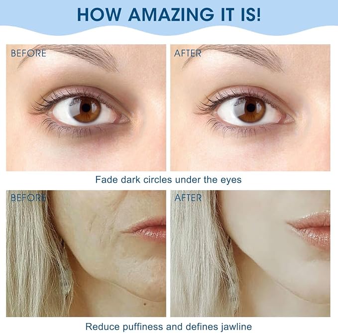 Face Roller & Gua Sha, Stainless Steel Facial Roller and Gua Sha Tool for Face, Skin Care, Anti-Aging, and Lifting